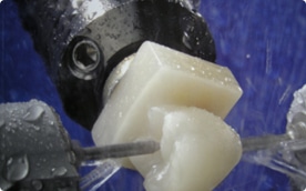A ceramic crown being milled chairside to be fitted in a patient’s mouth