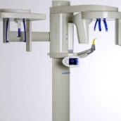 A CBCT machine