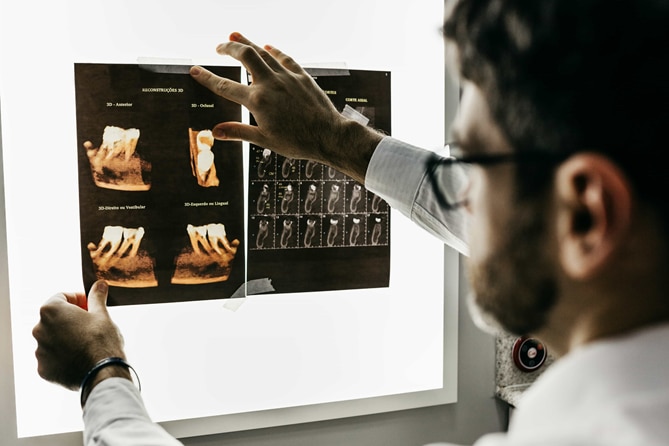 A dentist looking at a dental x-ray for a root canal treatment