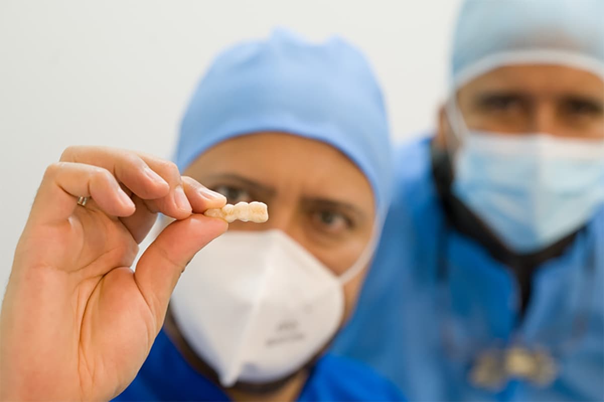 Dentist examines dental crowns