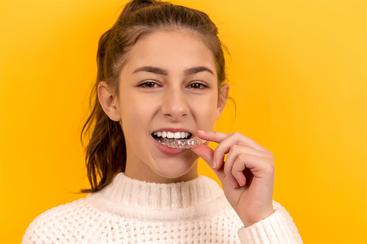 Girl removing Invisalign braces while smiling